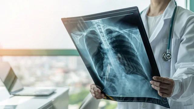 kxc3owu3wxuddywlajla7c3w6x68yr1i