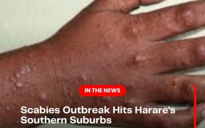 Scabies hits parts of Harare